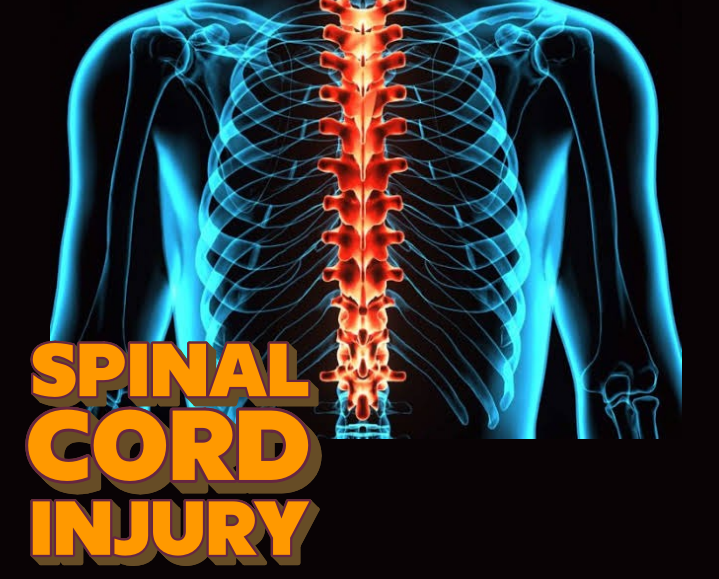 spinal cord injury lawsuit