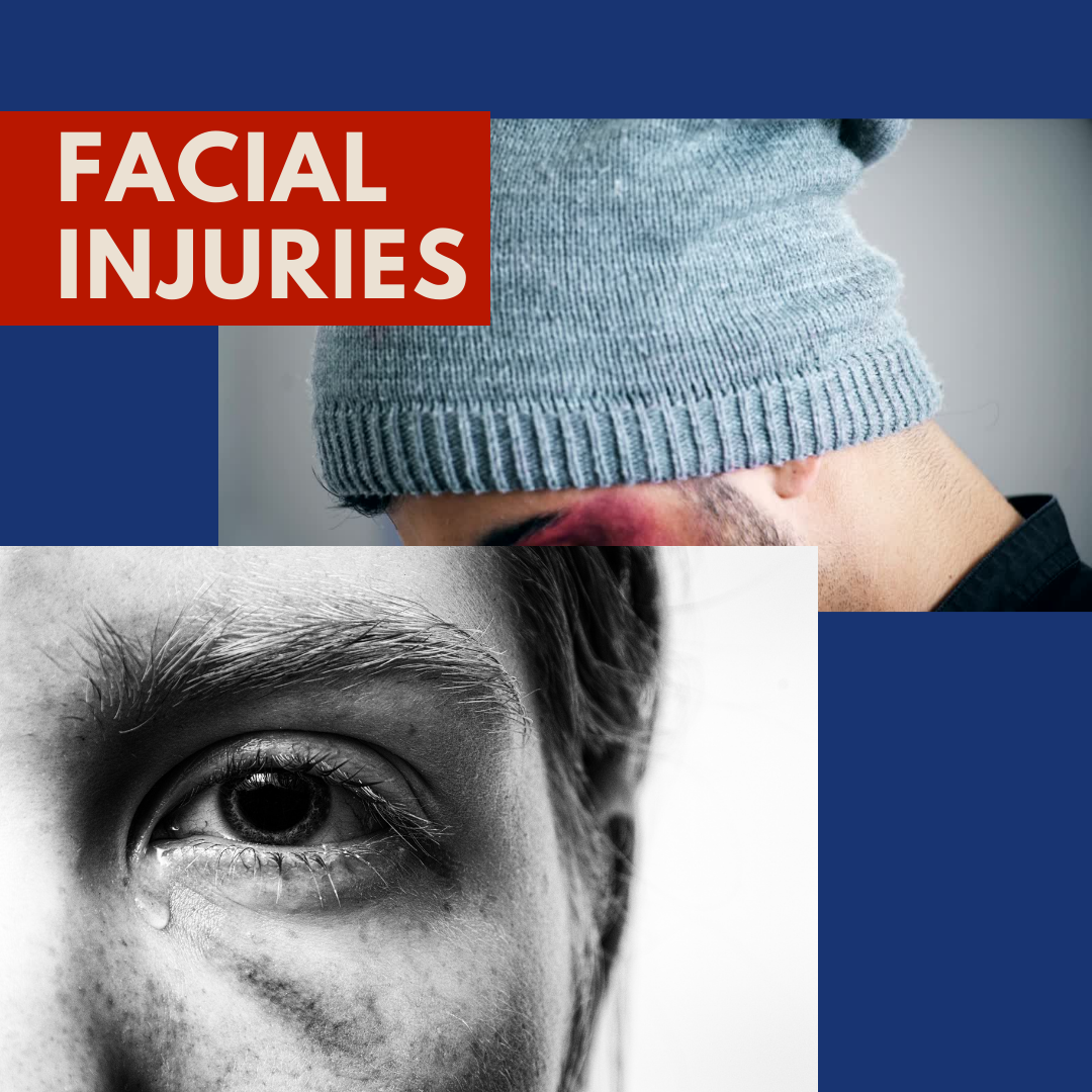 facial injury lawsuit