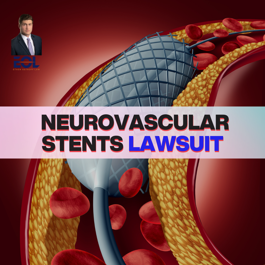 neurovascular stent lawsuit