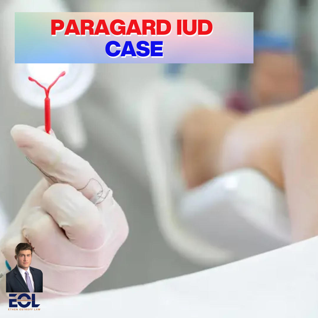 Paragard lawsuit