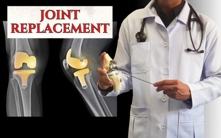 Joint Replacement Lawsuit