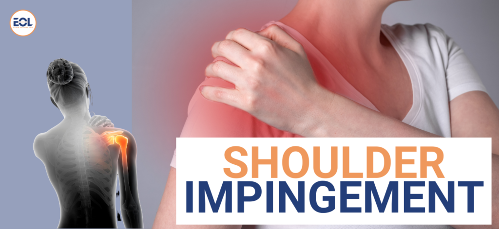 Shoulder Impingement Claim