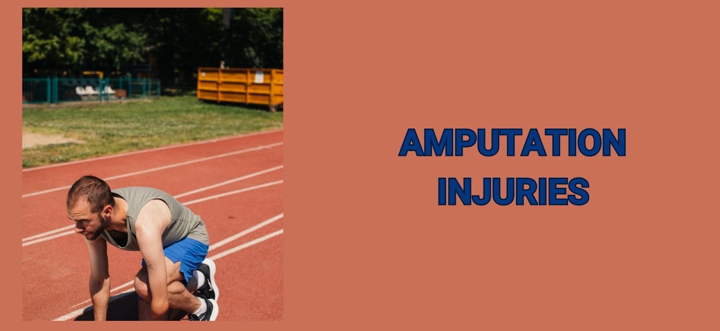 Amputation Injury Lawsuit