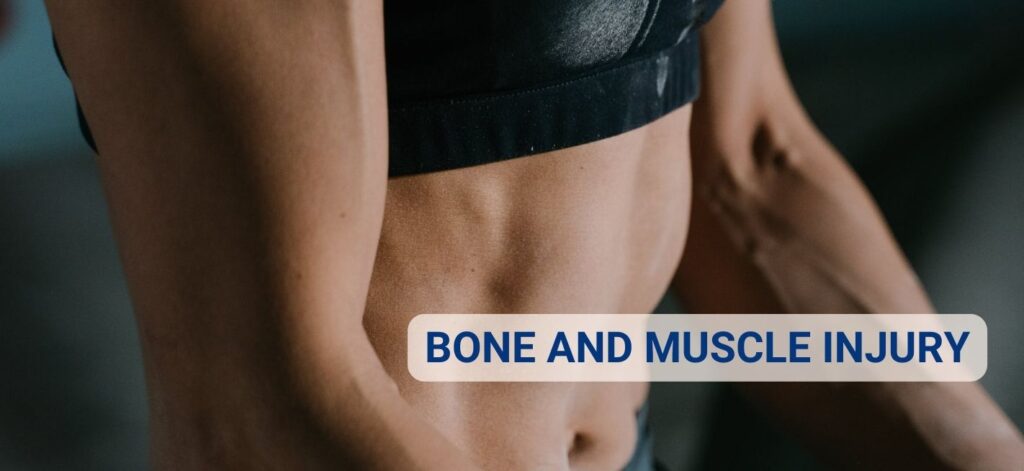Bone and Muscle Injury Lawsuit