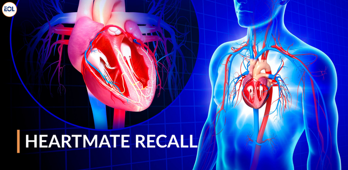 HeartMate Recall