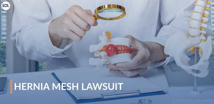 Hernia Mesh Lawsuit