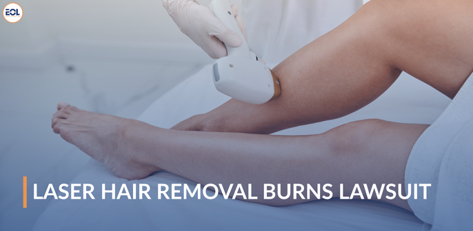 Laser Hair Removal Burns Lawsuit