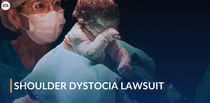 Shoulder Dystocia Lawsuit