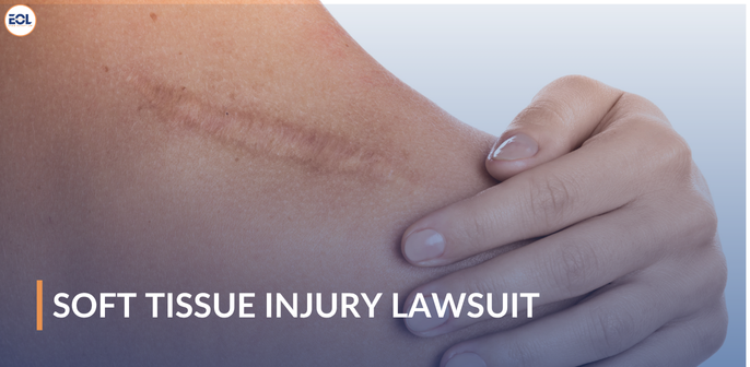Soft Tissue Injury Lawsuit