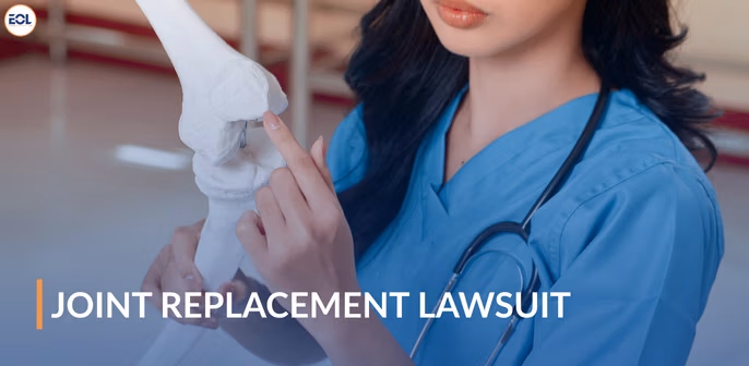 Medical professional demonstrating knee joint replacement model, emphasizing joint replacement lawsuit context.